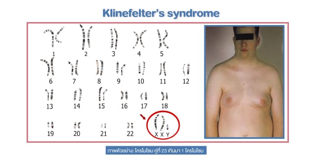 เป็นหมัน Beyond ivf มีลูกยากอยากมีลูก มีลูกแฝด ทำกิ๊ฟท์ IVF IUI ICSI ศูนย์รักษามีบุตรยาก