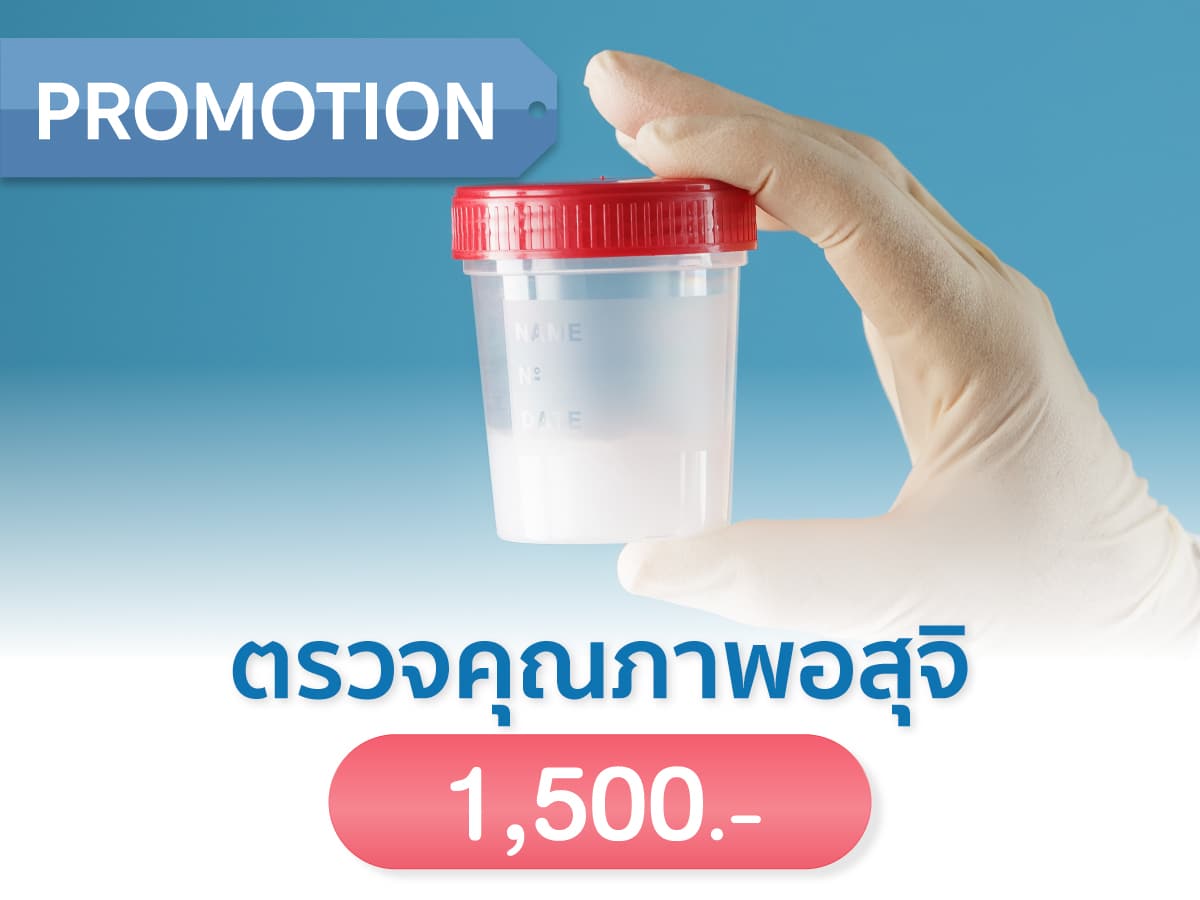 ราคาตรวจคุณภาพอสุจิ ตรวจอสุจิ ราคา Beyond IVF