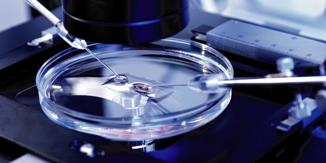 Beyond ivf มีลูกยากอยากมีลูก มีลูกแฝด ทำกิ๊ฟท์ IVF IUI ICSI ศูนย์รักษามีบุตรยาก