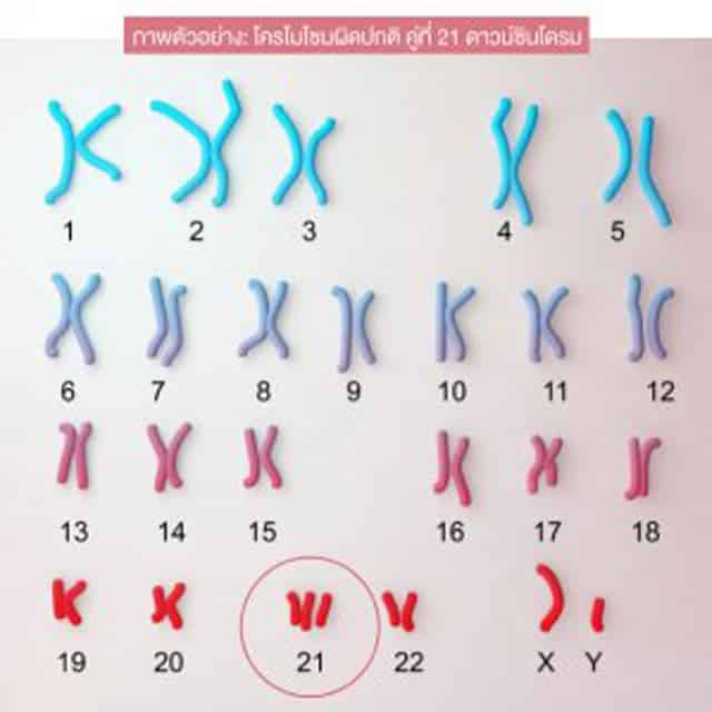 NGS-ทำ-ICSI-เด็กหลอดแก้ว-BeyondIVF