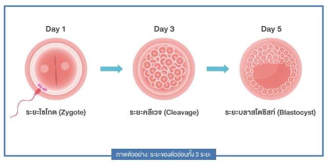 ตัวอ่อนระยะ 3 วัน VS 5 วัน ระยะไหนมีโอกาสสำเร็จมากกว่า beyond ivf หมอต้น พูนศักดิ์