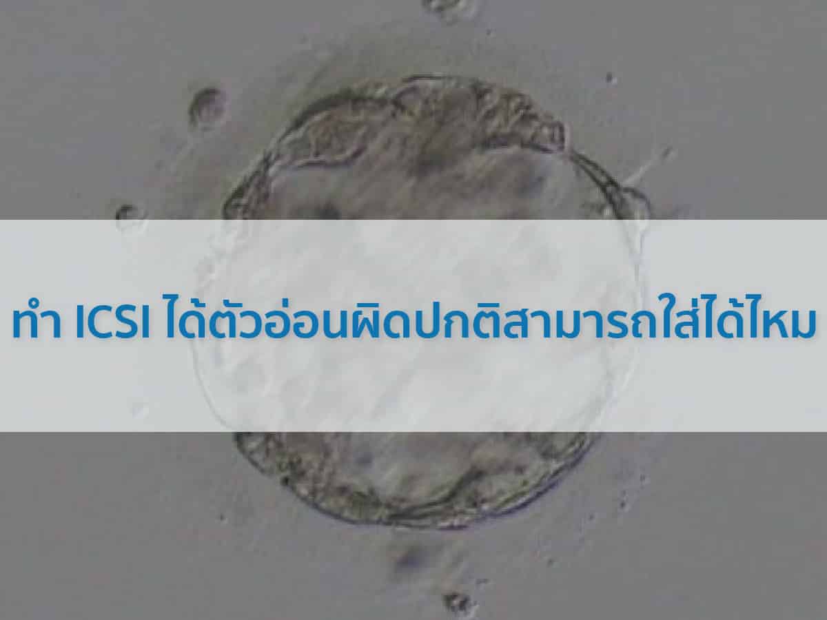 ตัวอ่อนผิดปกติ ทำ ICSI ได้ตัวอ่อนผิดปกติสามารถใส่ได้ไหม Beyond IVF