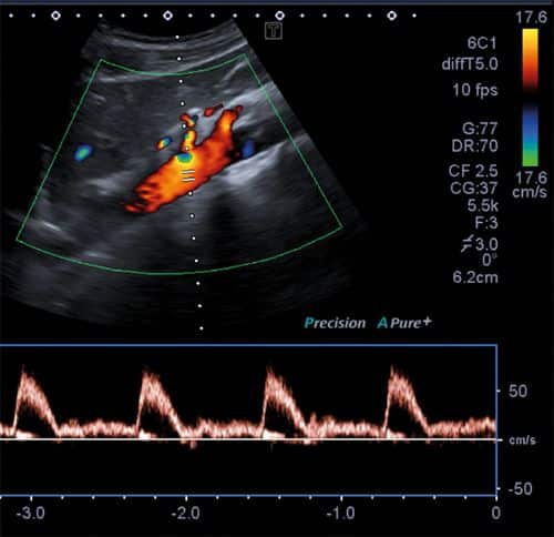 เสียงหัวใจทารก จะได้ยินตอนอายุครรภ์กี่สัปดาห์ เสียงหัวใจลูก Beyond IVF