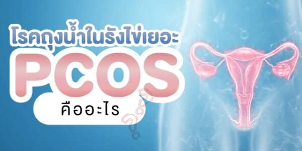 โรคถุงน้ำในรังไข่หลายใบ หรือ PCOS คืออะไร Beyond IVF