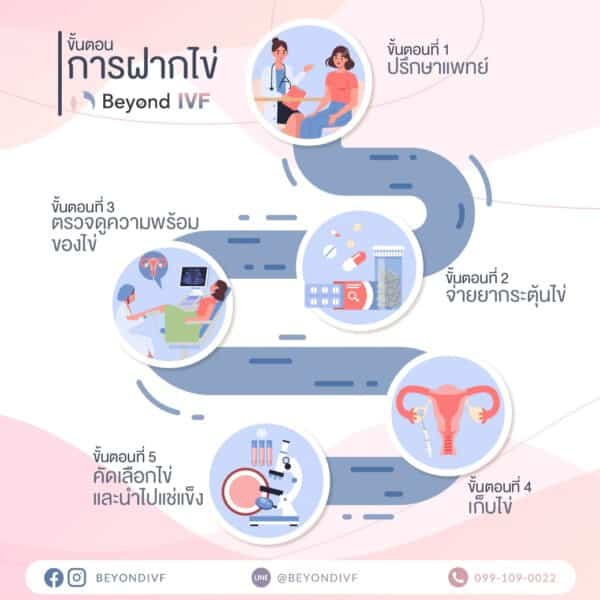 รีวิวฝากไข่ ฝากไข่ ขั้นตอนการฝากไข่ Beyond IVF