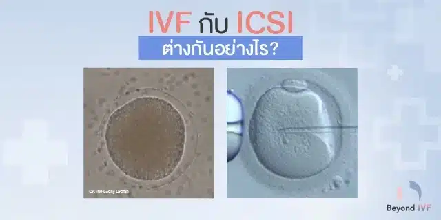 ICSI ต่างกับ IVF อย่างไร