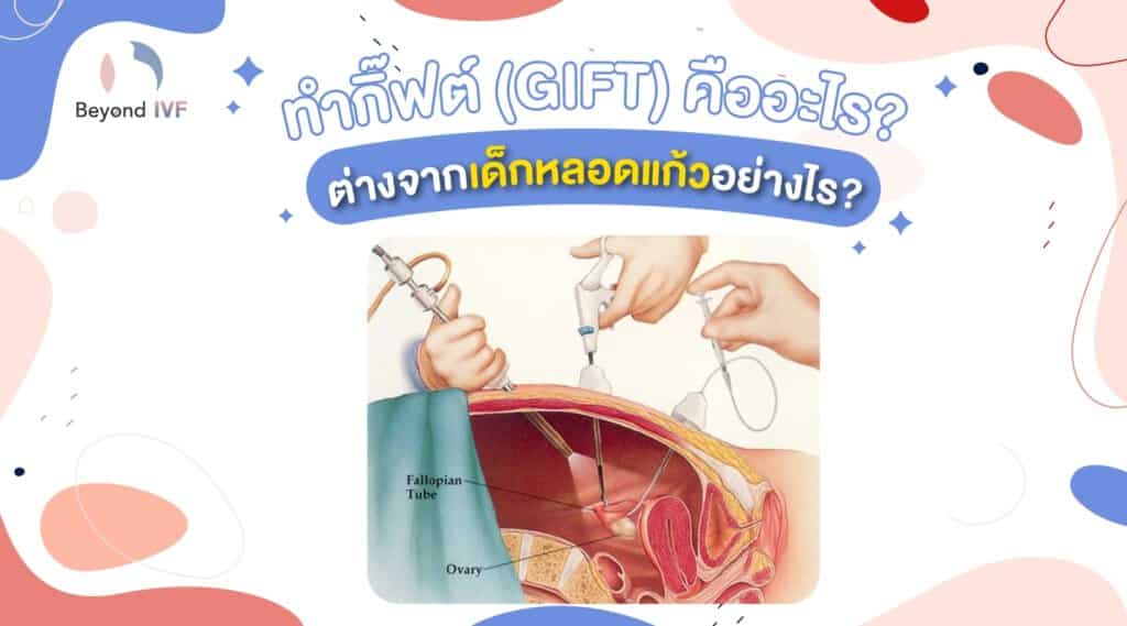 ทํากิ๊ฟท์ (GIFT) คืออะไร มีขั้นตอนอย่างไร