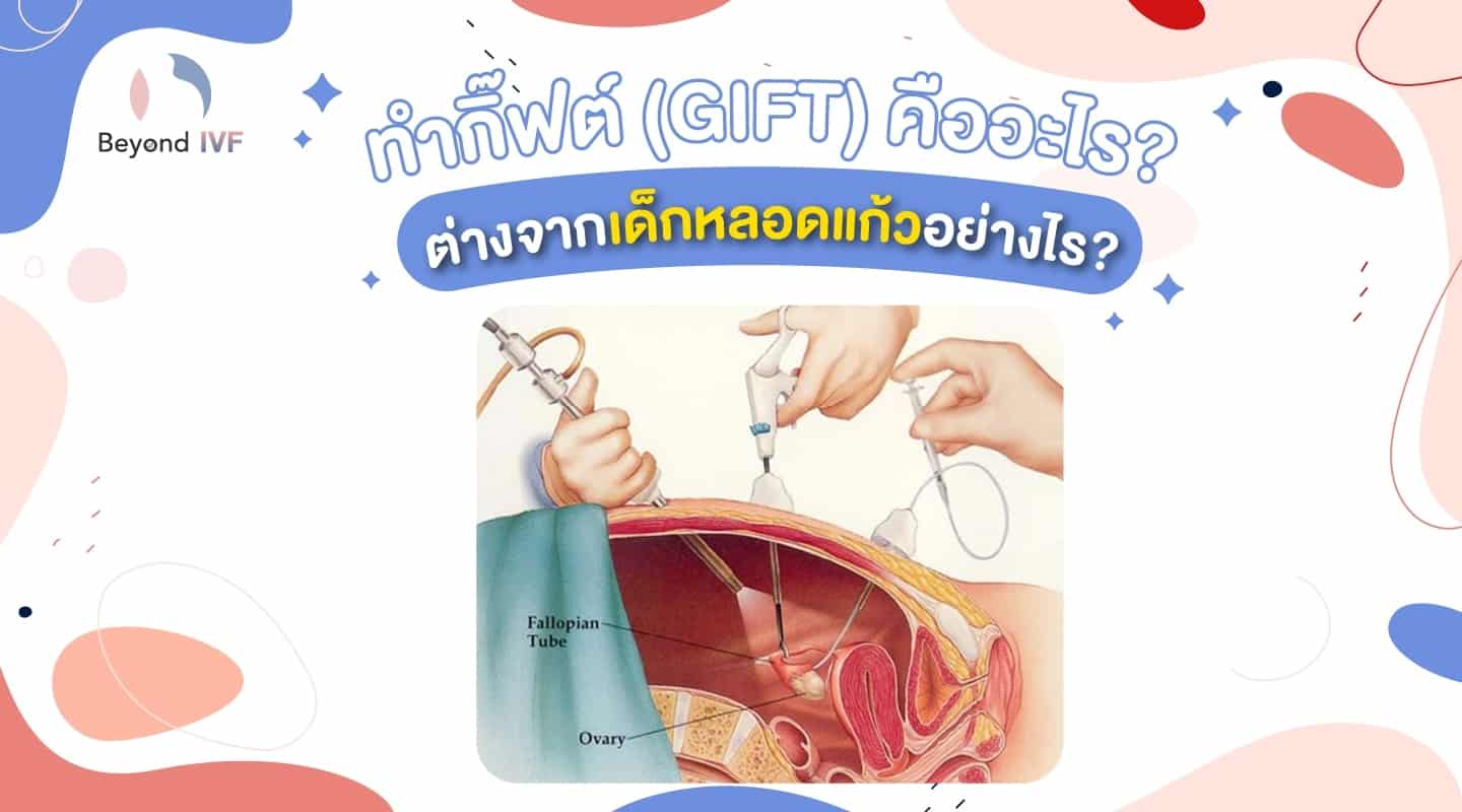 ทํากิ๊ฟท์ (GIFT) คืออะไร มีขั้นตอนอย่างไร