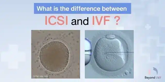 a difference between icsi and ivf