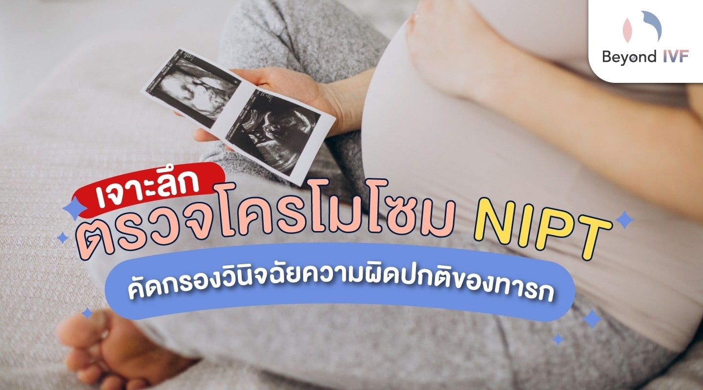 ตรวจโครโมโซม