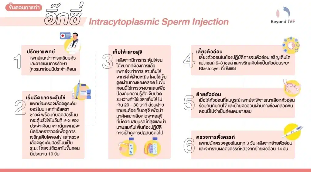 ขั้นตอนการทำ ICSI