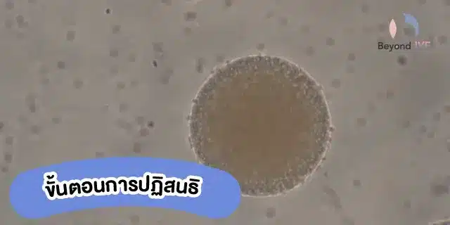 ขั้นตอนการปฏิสนธิ