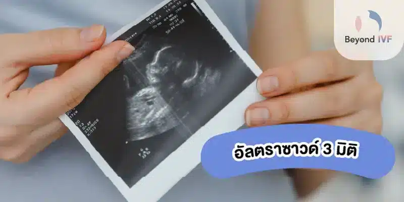อัลตร้าซาวด์ 3 มิติ
