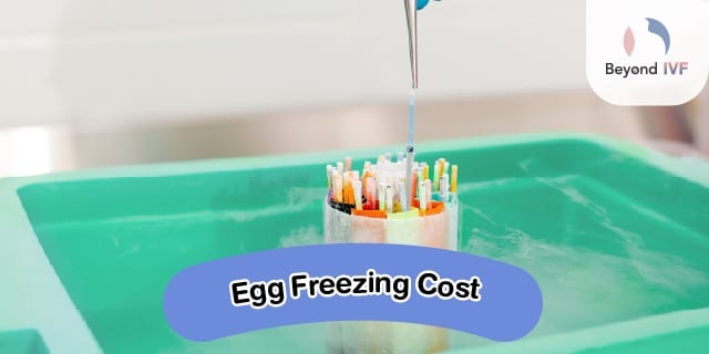 freezing price