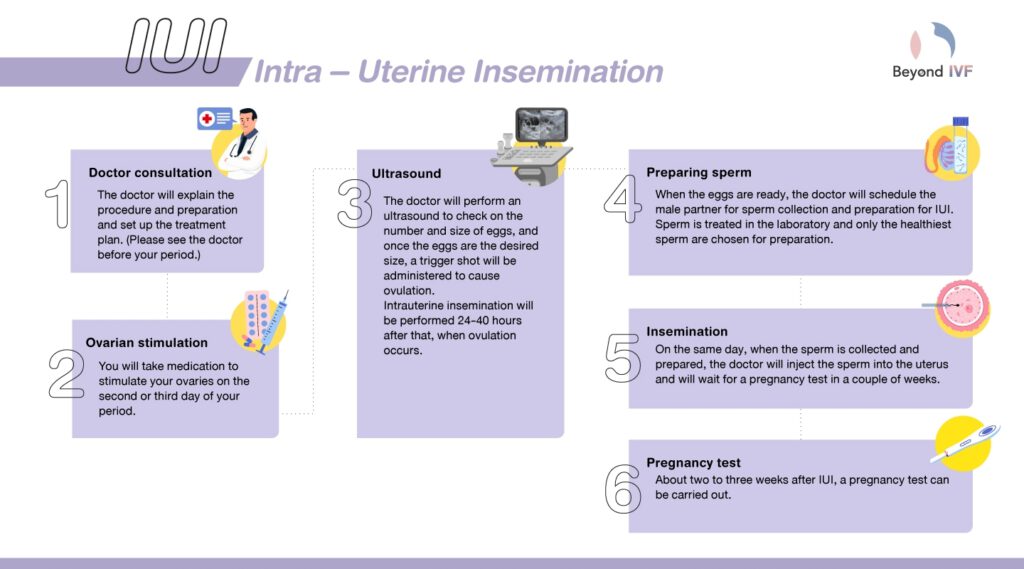 iui procedure