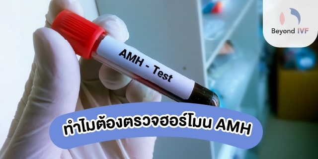 ค่าฮอร์โมน amh