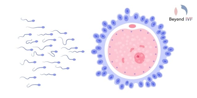 ivf fertility treatment