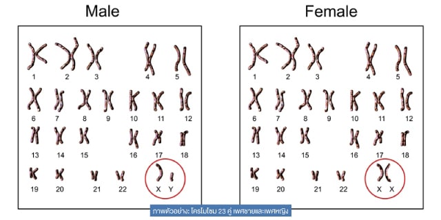 Sex selection IVF