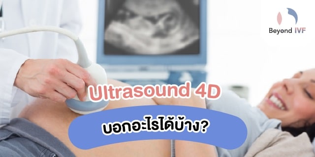 ultrasound 4 มิติ
