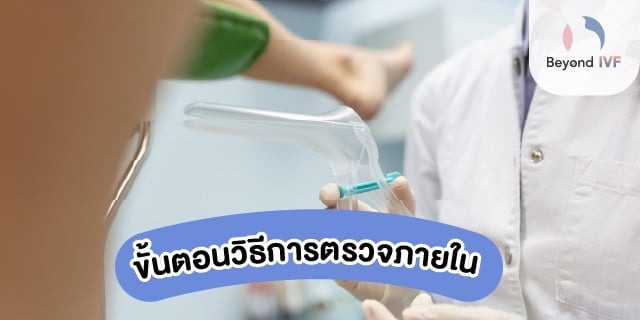 การตรวจภายใน