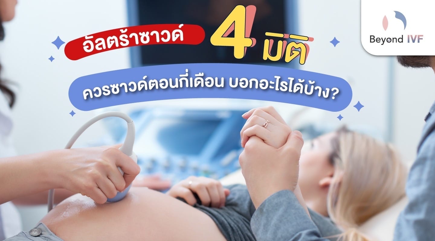 อัลตร้าซาวด์ 4 มิติ