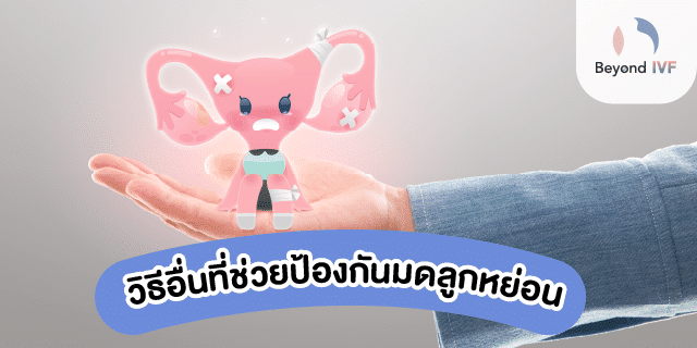ลิสต์แนะนำวิธีป้องกันมดลูกหย่อน