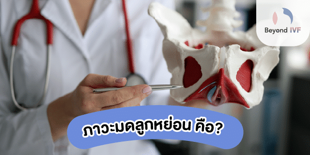 อธิบายโดยละเอียดเกี่ยวกับปัญหามดลูกหย่อนในผู้หญิง