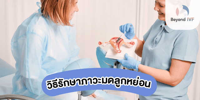 วิธีรักษามดลูกหย่อน