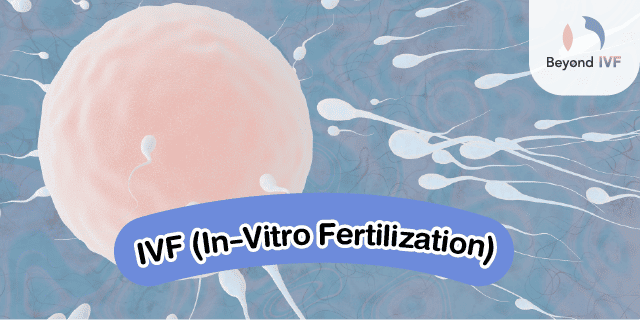 icsi ivf