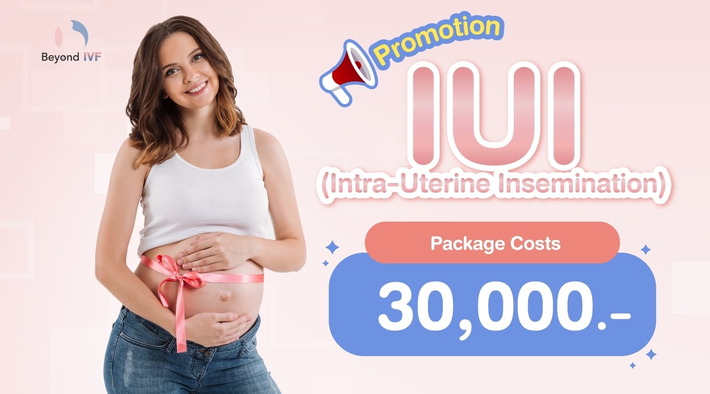 IUI