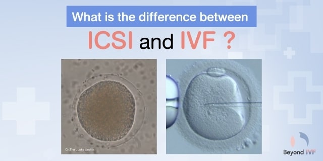 ivf icsi process