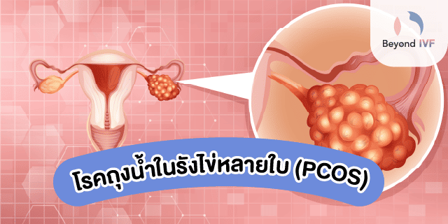 ประจําเดือนไม่มา แต่มีตกขาว