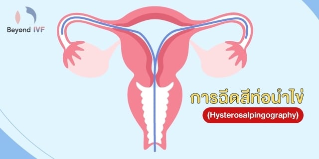 อธิบายให้เข้าใจเกี่ยวกับการฉีดสีท่อน้ำไข่