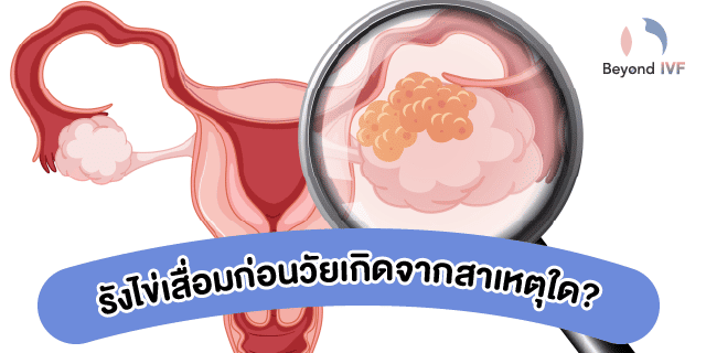 premature ovarian failure คือ