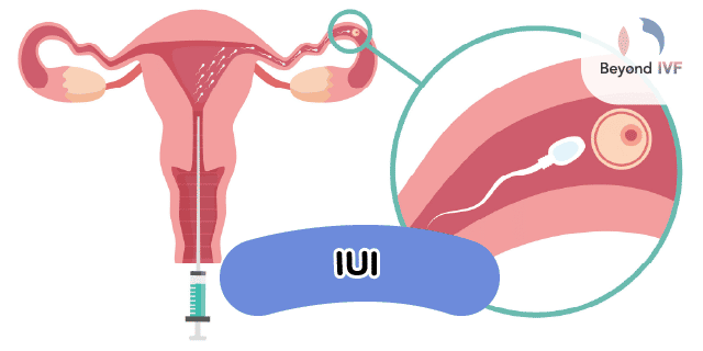 sperm checks