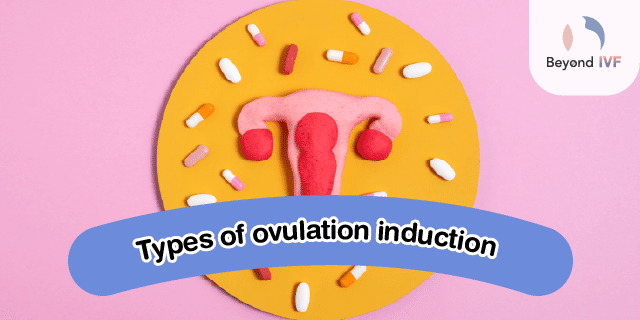 trigger ovulation
