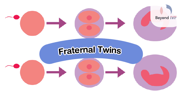 Fraternal Twins