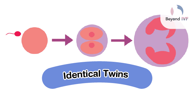 Identical Twins