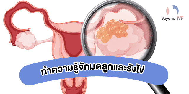 ตรวจอัลตร้าซาวด์มดลูกและรังไข่