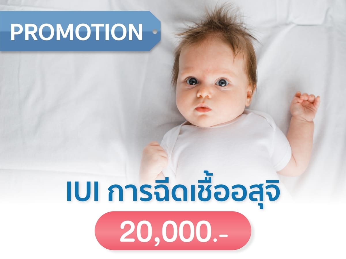 IUI ราคา โปรโมชั่น Beyond ivf 20,000