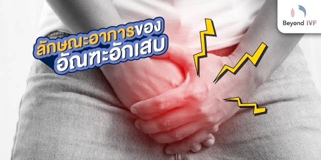 อัณฑะบวม