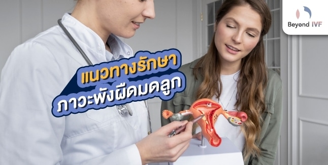 พังผืดมดลูกกับภาวะ รักษา