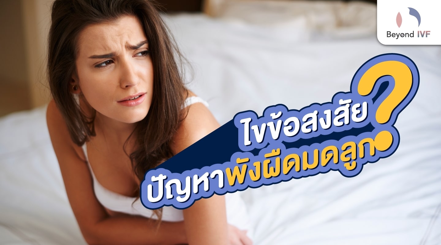 พังผืดมดลูก