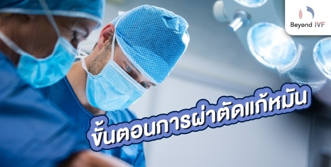ขั้นตอนแก้หมัน
